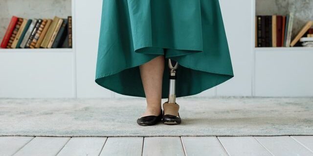 Young lady with an prosthetic leg and a stock of books